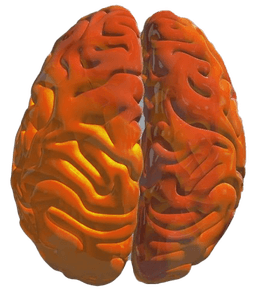 Brain before treatment - dysregulated activity